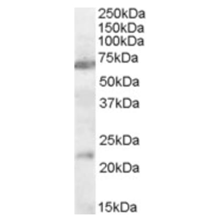 Western Blot - Anti-CHRNA4 Antibody (A83491) - Antibodies.com