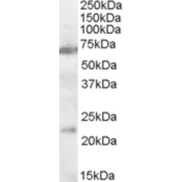 Western Blot - Anti-CHRNA4 Antibody (A83491) - Antibodies.com