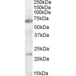 Western Blot - Anti-CHRNA4 Antibody (A83491) - Antibodies.com