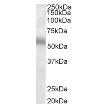 Western Blot - Anti-TFEB Antibody (A83495) - Antibodies.com