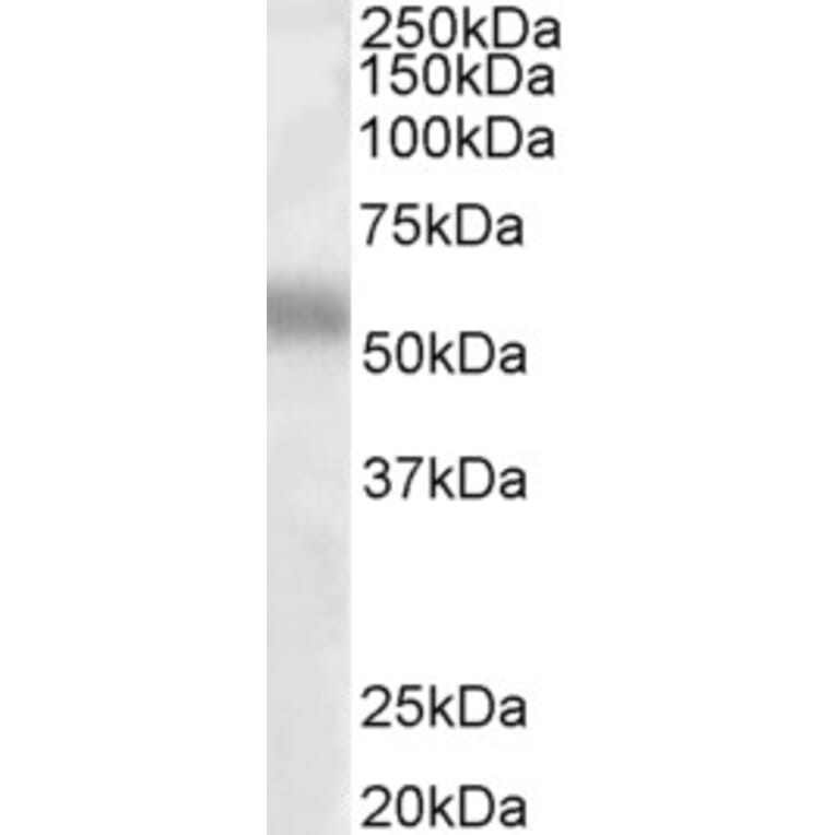 Western Blot - Anti-TFEB Antibody (A83495) - Antibodies.com