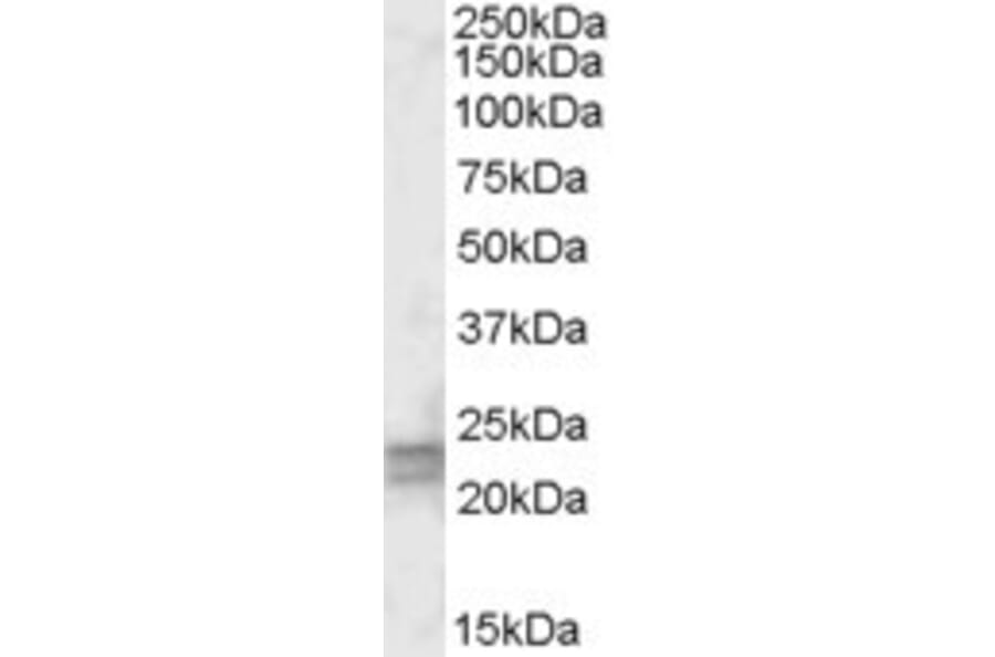 Western Blot - Anti-ARL4D Antibody (A83496) - Antibodies.com