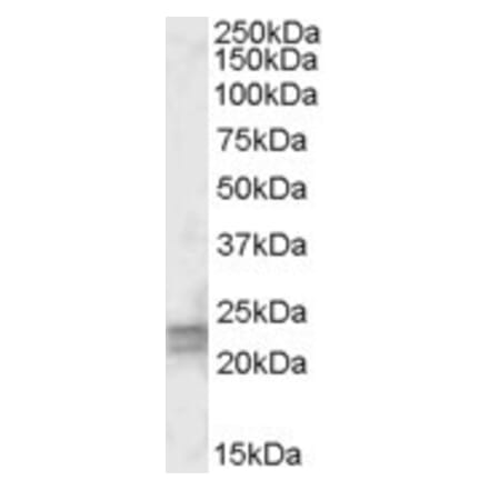 Western Blot - Anti-ARL4D Antibody (A83496) - Antibodies.com