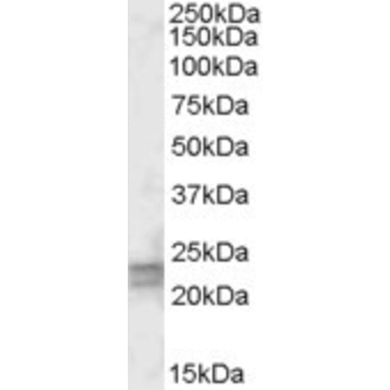 Western Blot - Anti-ARL4D Antibody (A83496) - Antibodies.com