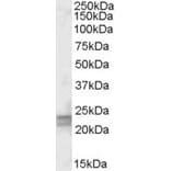 Western Blot - Anti-ARL4D Antibody (A83496) - Antibodies.com