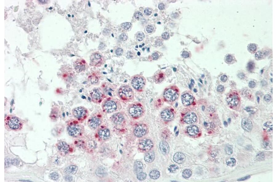 Immunohistochemistry - Anti-HGFA Inhibitor 2 Antibody (A83497) - Antibodies.com