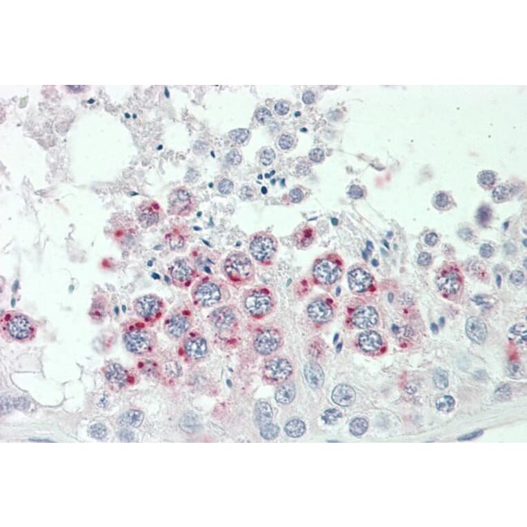 Immunohistochemistry - Anti-HGFA Inhibitor 2 Antibody (A83497) - Antibodies.com