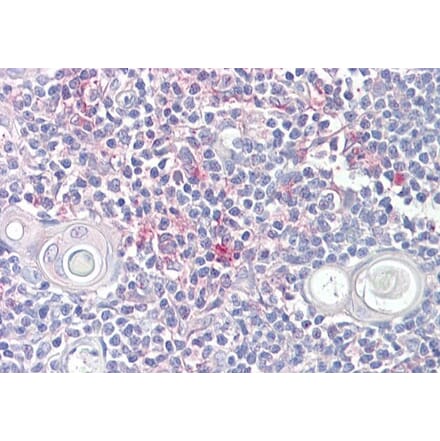 Immunohistochemistry - Anti-LITAF Antibody (A83498) - Antibodies.com