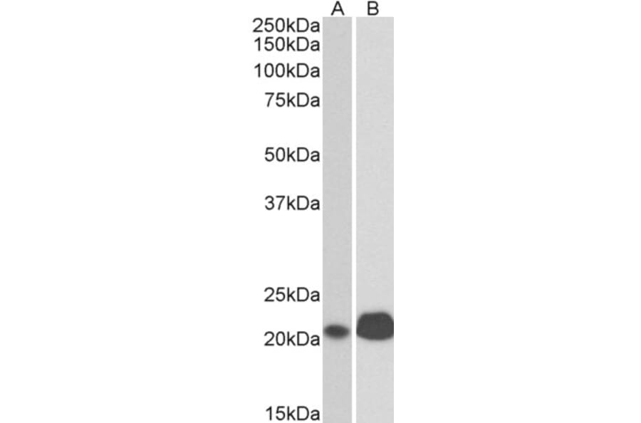 Western Blot - Anti-CD3 epsilon Antibody (A83499) - Antibodies.com