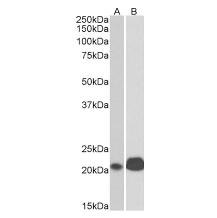 Western Blot - Anti-CD3 epsilon Antibody (A83499) - Antibodies.com