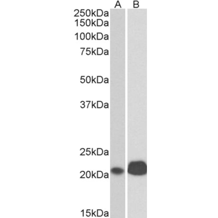Western Blot - Anti-CD3 epsilon Antibody (A83499) - Antibodies.com