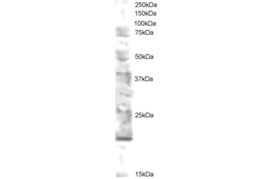 Western Blot - Anti-MMS2 Antibody (A83500) - Antibodies.com