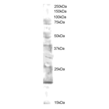 Western Blot - Anti-MMS2 Antibody (A83500) - Antibodies.com