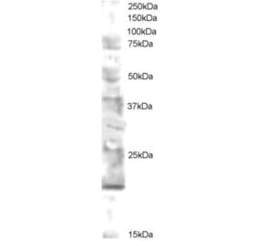 Western Blot - Anti-UBE2V2 Antibody (A83500) - Antibodies.com