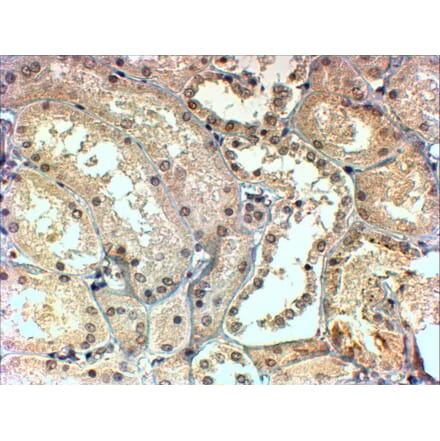 Immunohistochemistry - Anti-TBL1X Antibody (A83502) - Antibodies.com