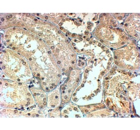 Immunohistochemistry - Anti-TBL1X / TBL1XR1 Antibody (A83502) - Antibodies.com