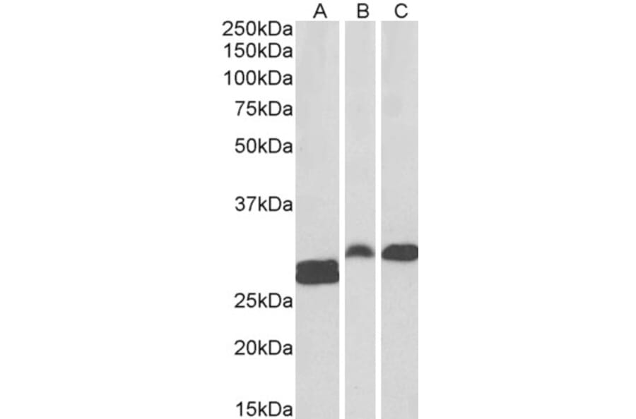 Western Blot - Anti-ANP32B Antibody (A83503) - Antibodies.com
