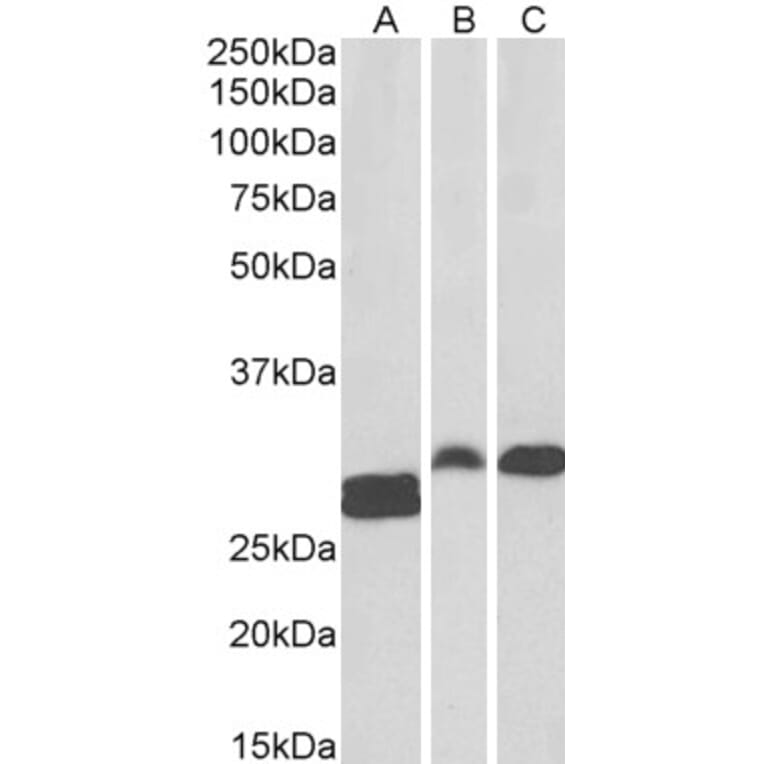 Western Blot - Anti-ANP32B Antibody (A83503) - Antibodies.com
