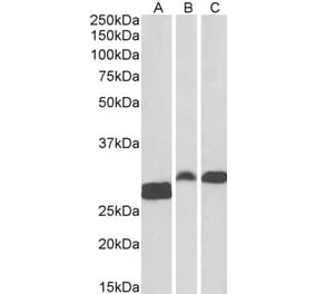 Western Blot - Anti-ANP32B Antibody (A83503) - Antibodies.com