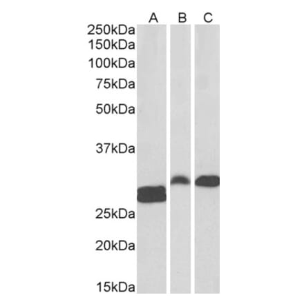 Western Blot - Anti-ANP32B Antibody (A83503) - Antibodies.com
