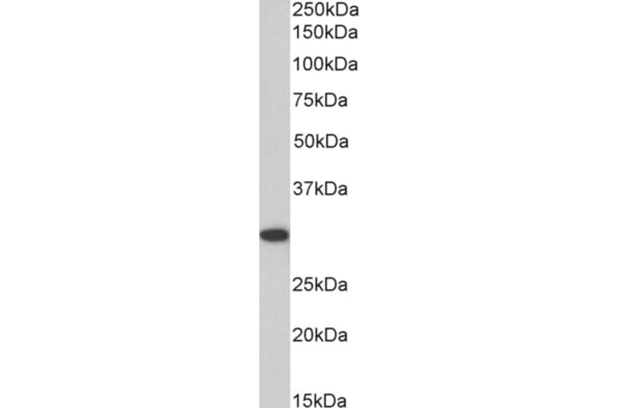 Western Blot - Anti-ANP32B Antibody (A83503) - Antibodies.com