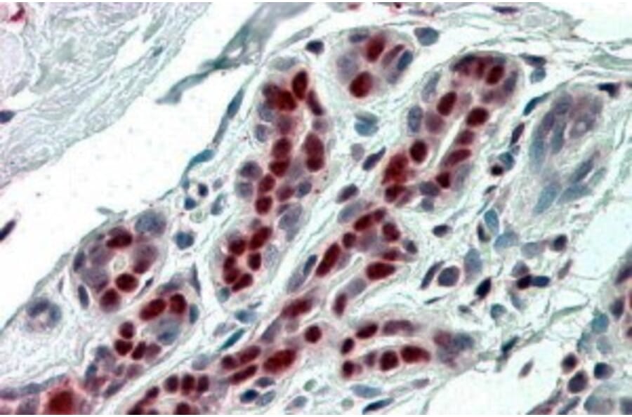 Immunohistochemistry - Anti-ANP32B Antibody (A83503) - Antibodies.com