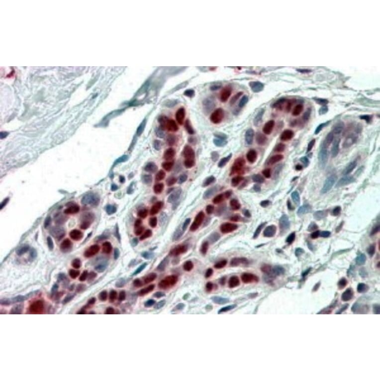 Immunohistochemistry - Anti-ANP32B Antibody (A83503) - Antibodies.com
