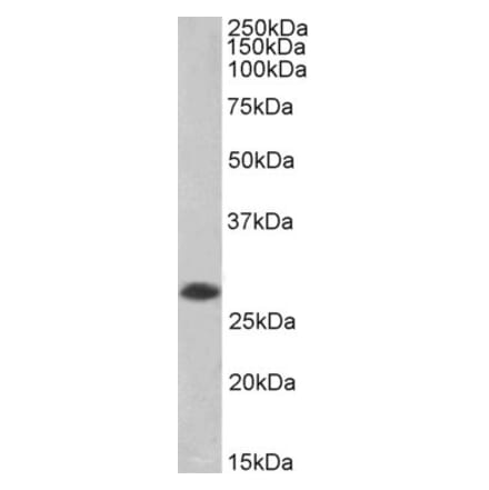Western Blot - Anti-ANP32B Antibody (A83504) - Antibodies.com