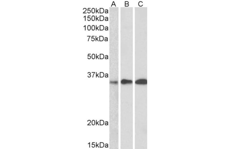 Western Blot - Anti-EFHD2/SWS1 Antibody (A83505) - Antibodies.com
