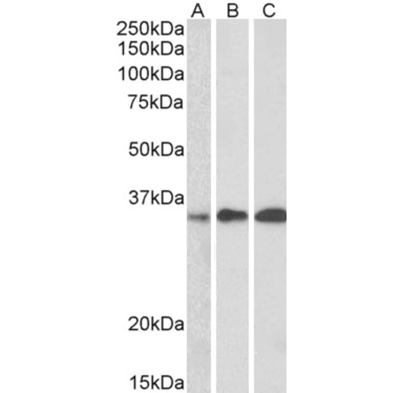 Western Blot - Anti-EFHD2/SWS1 Antibody (A83505) - Antibodies.com
