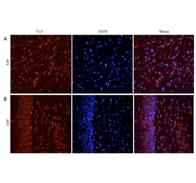 Immunohistochemistry - Anti-CHRNA7 Antibody (A83507) - Antibodies.com