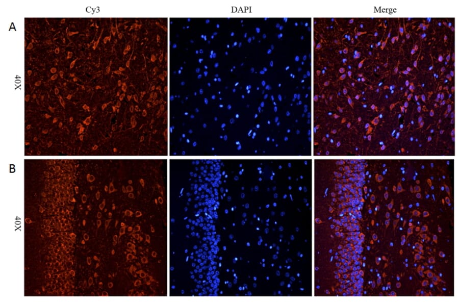 Immunohistochemistry - Anti-CHRNA7 Antibody (A83507) - Antibodies.com