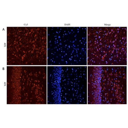 Immunohistochemistry - Anti-CHRNA7 Antibody (A83507) - Antibodies.com