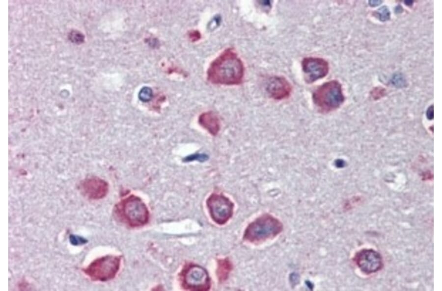 IHC of human cortex using Anti-CHRNA7 Antibody (A83507)