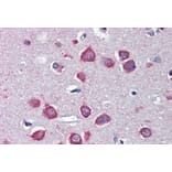 Immunohistochemistry - Anti-CHRNA7 Antibody (A83507) - Antibodies.com