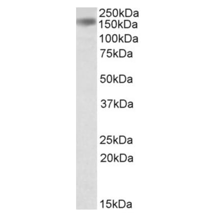 Western Blot - Anti-RNASEN Antibody (A83508) - Antibodies.com