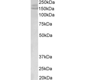 Western Blot - Anti-AKAP12 Antibody (A83509) - Antibodies.com