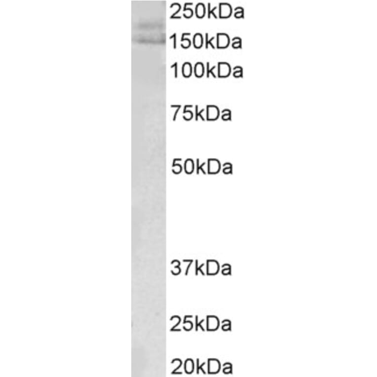 Western Blot - Anti-AKAP12 Antibody (A83509) - Antibodies.com