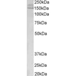 Western Blot - Anti-AKAP12 Antibody (A83509) - Antibodies.com