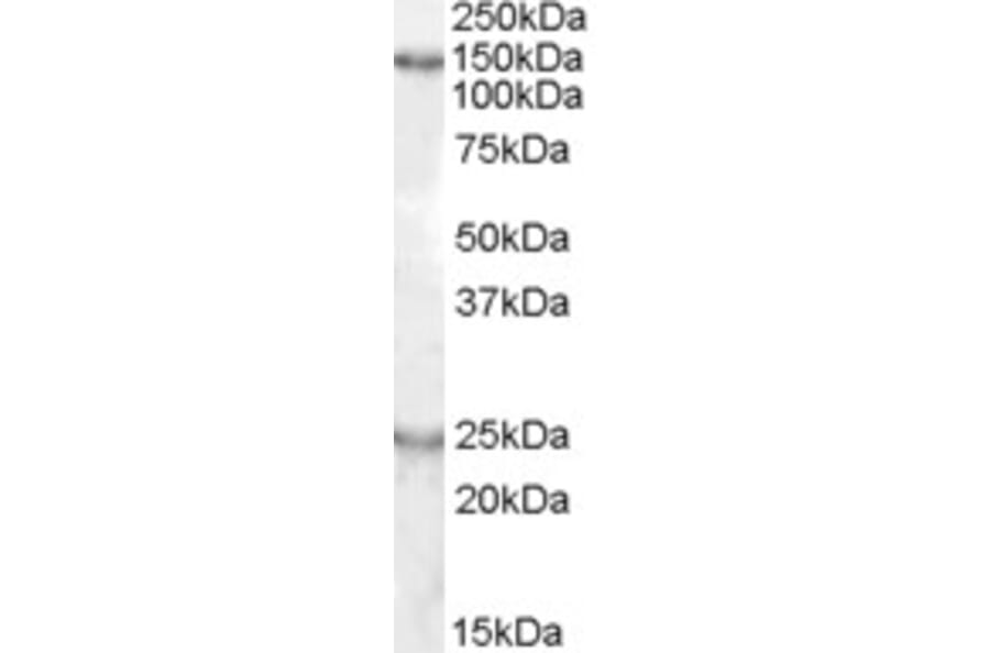 Western Blot - Anti-KIAA0319 Antibody (A83510) - Antibodies.com