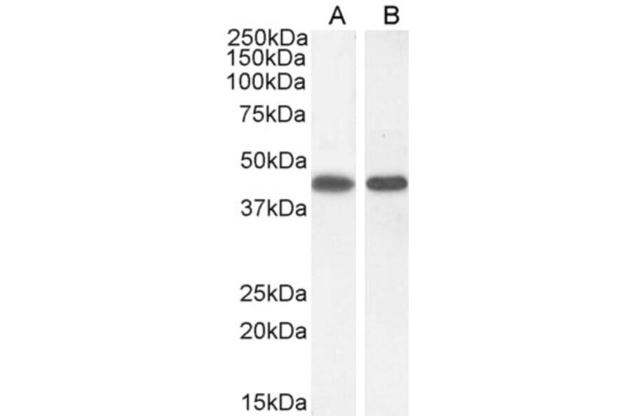 Western Blot - Anti-ASS1 Antibody (A83511) - Antibodies.com