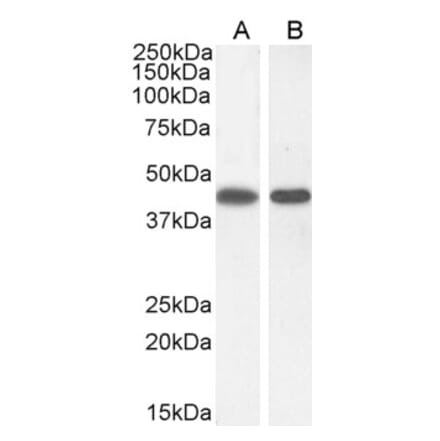 Western Blot - Anti-ASS1 Antibody (A83511) - Antibodies.com