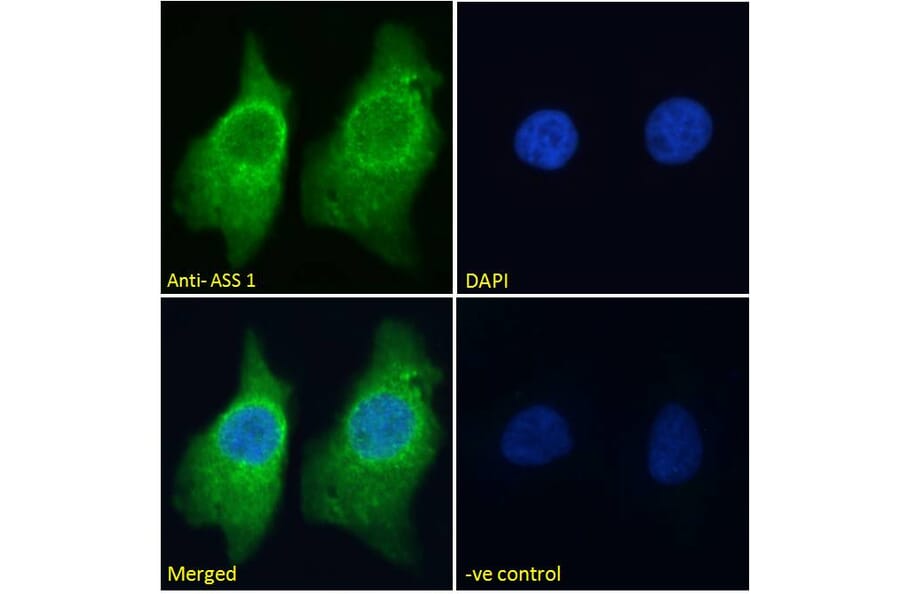 Immunofluorescence - Anti-ASS1 Antibody (A83511) - Antibodies.com