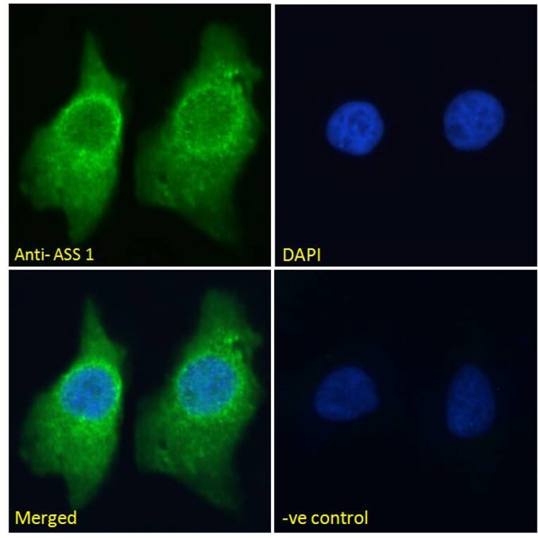 Immunofluorescence - Anti-ASS1 Antibody (A83511) - Antibodies.com