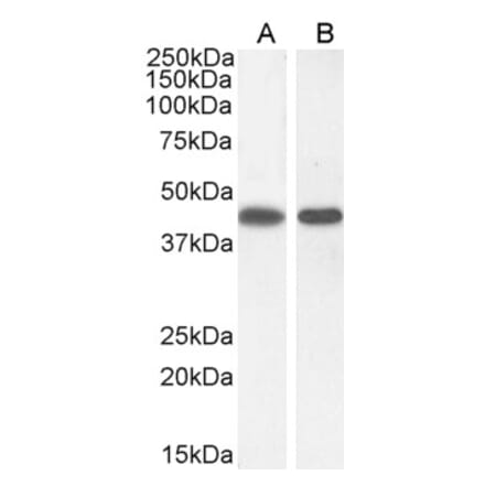 Western Blot - Anti-ASS1 Antibody (A83511)