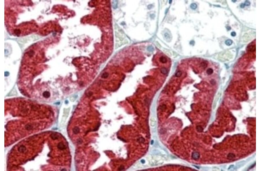 Immunohistochemistry - Anti-ASS1 Antibody (A83511) - Antibodies.com