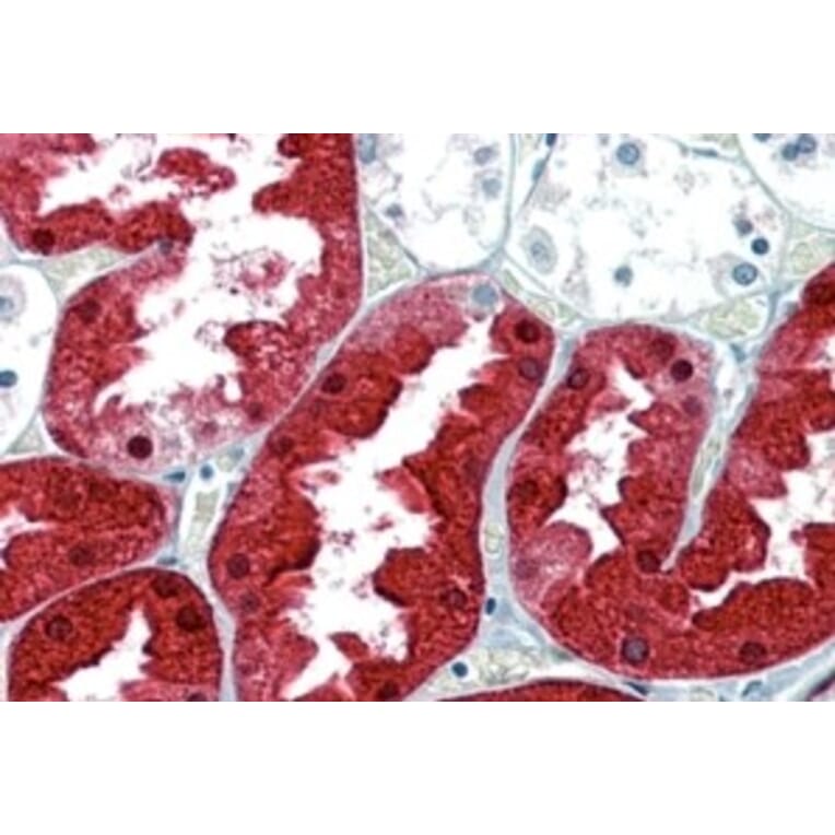 Immunohistochemistry - Anti-ASS1 Antibody (A83511) - Antibodies.com