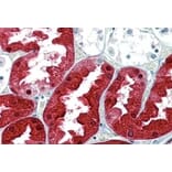 Immunohistochemistry - Anti-ASS1 Antibody (A83511) - Antibodies.com