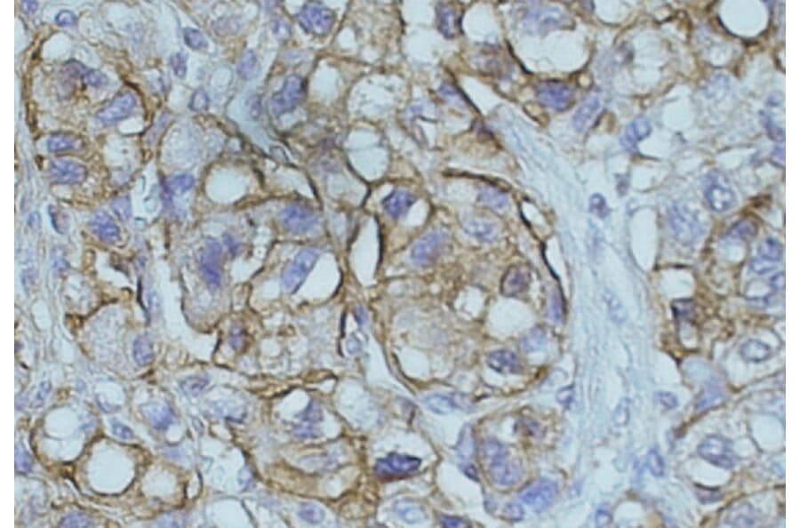 Immunohistochemistry - Anti-NDRG1 Antibody (A83512) - Antibodies.com