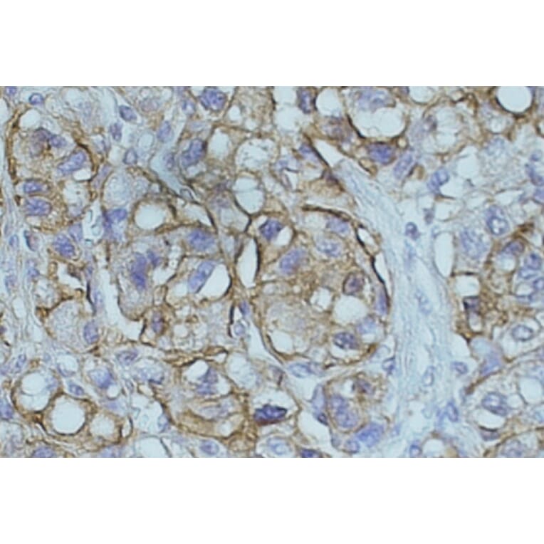 Immunohistochemistry - Anti-NDRG1 Antibody (A83512) - Antibodies.com